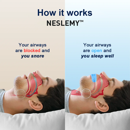 NESLEMY™ Professional intelligent anti-snoring device